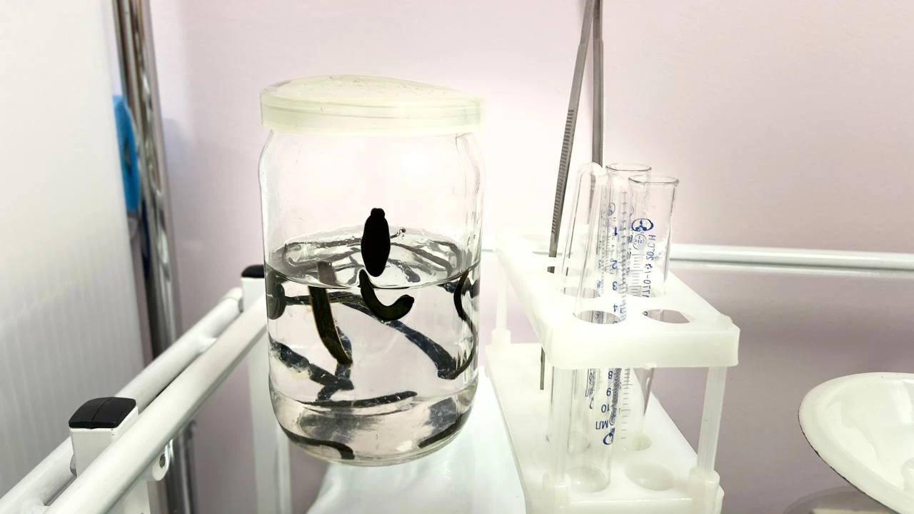 Гирудотерапия в санатории «Казахстан» 